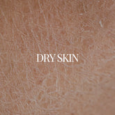 Regimen For Dry Skin